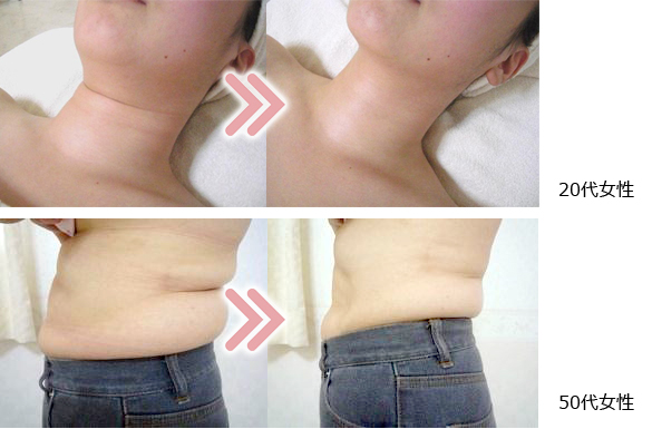 �u�����@�{�p��